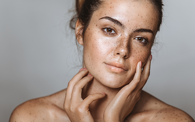 Woman with freckles