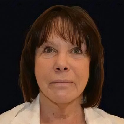 Thermitight Before & After Patient #17302