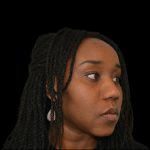 Rhinoplasty Before & After Patient #19528
