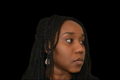 Rhinoplasty Before & After Patient #19528