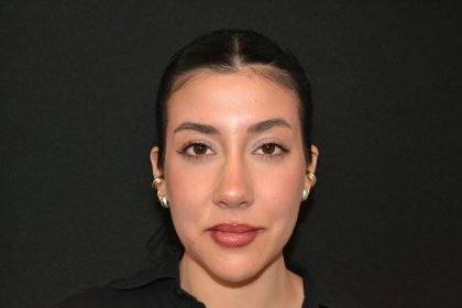 Rhinoplasty Before & After Patient #19536