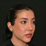 Rhinoplasty Before & After Patient #19536