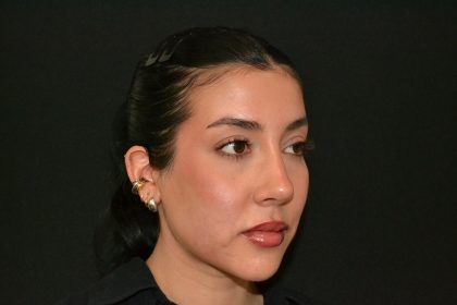 Rhinoplasty Before & After Patient #19536