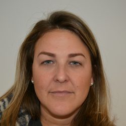 Blepharoplasty Before & After Patient #19618