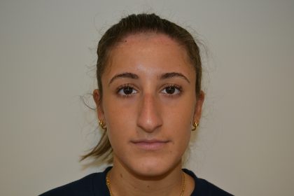 Rhinoplasty Before & After Patient #19621