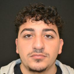 Rhinoplasty Before & After Patient #19853