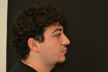 Rhinoplasty Before & After Patient #19853