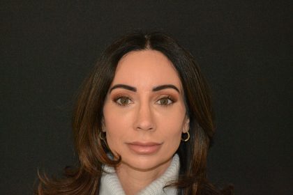 Rhinoplasty Before & After Patient #19857